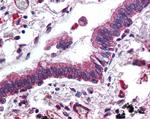 ErbB3 Antibody in Immunohistochemistry (Paraffin) (IHC (P))