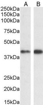 ERK1 Antibody in Western Blot (WB)