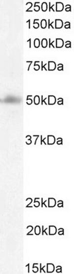 FOXG1 Antibody in Western Blot (WB)