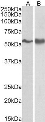 Fyn Antibody in Western Blot (WB)