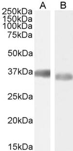 GAPDH Antibody in Western Blot (WB)