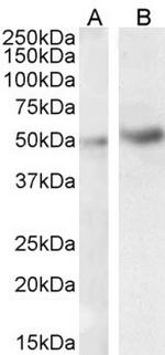 IRAK4 Antibody in Western Blot (WB)