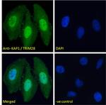 TRIM28 Antibody in Immunocytochemistry (ICC/IF)