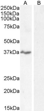 NKG2D Antibody in Western Blot (WB)