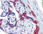 PAI1 Antibody in Immunohistochemistry (Paraffin) (IHC (P))