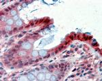 15-PGDH Antibody in Immunohistochemistry (Paraffin) (IHC (P))