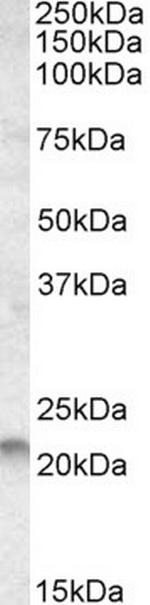 RAC2 Antibody in Western Blot (WB)