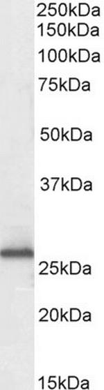 RANBP1 Antibody in Western Blot (WB)