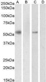 RXRA Antibody in Western Blot (WB)