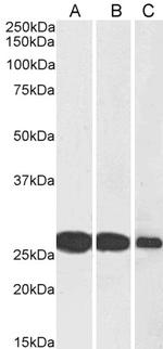 SNAP25 Antibody in Western Blot (WB)