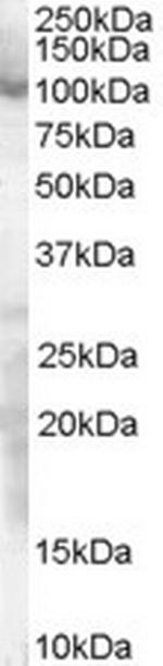 SP1 Antibody in Western Blot (WB)