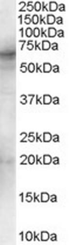 Syk Antibody in Western Blot (WB)