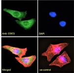 STAT3 Antibody in Immunocytochemistry (ICC/IF)