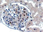 UBC9 Antibody in Immunohistochemistry (Paraffin) (IHC (P))