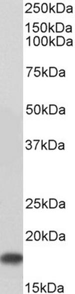 UBC9 Antibody in Western Blot (WB)