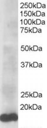 UBE2L3 Antibody in Western Blot (WB)