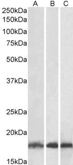 UBE2L3 Antibody in Western Blot (WB)