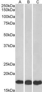 UBE2L3 Antibody in Western Blot (WB)