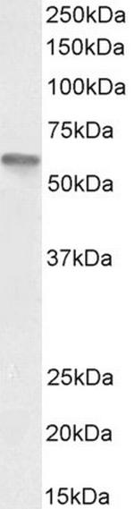 VDR Antibody in Western Blot (WB)