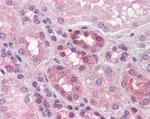 PCSK6 Antibody in Immunohistochemistry (Paraffin) (IHC (P))