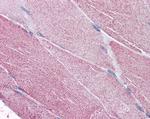 PCSK6 Antibody in Immunohistochemistry (Paraffin) (IHC (P))