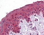 SAR1A Antibody in Immunohistochemistry (Paraffin) (IHC (P))