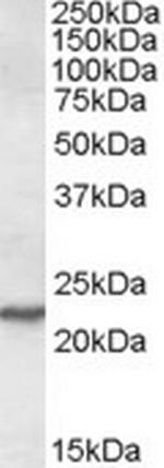 SAR1A Antibody in Western Blot (WB)