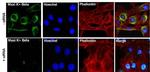 KCNMB1 Antibody in Immunocytochemistry (ICC/IF)