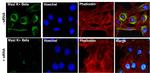 KCNMB1 Antibody