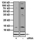 KCNMB1 Antibody in Western Blot (WB)