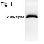 S100A1 Antibody in Western Blot (WB)