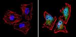 Calcium Sensing Receptor Antibody in Immunocytochemistry (ICC/IF)