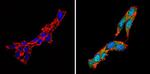 Calcium Sensing Receptor Antibody in Immunocytochemistry (ICC/IF)