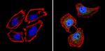 Calcium Sensing Receptor Antibody in Immunocytochemistry (ICC/IF)