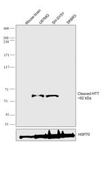 Huntingtin Antibody