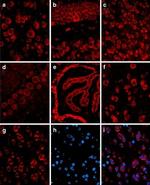 STUB1 Antibody in Immunohistochemistry (IHC)