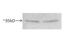 STUB1 Antibody in Western Blot (WB)