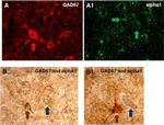 alpha-1a Adrenergic Receptor Antibody in Immunohistochemistry - Free Floating (IHC (Free))