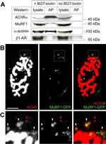 beta-1 Adrenergic Receptor Antibody in Western Blot (WB)