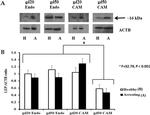 Leptin Antibody in Western Blot (WB)