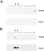 Caveolin 3 Antibody in Western Blot (WB)