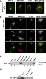 COPII Antibody in Immunocytochemistry (ICC/IF)