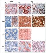 EBP50 Antibody in Immunohistochemistry (IHC)