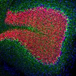 NEFL Antibody in Immunocytochemistry (ICC/IF)