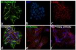 NEFM Antibody in Immunocytochemistry (ICC/IF)