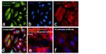 Vimentin Antibody in Immunocytochemistry (ICC/IF)