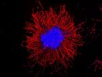 Vimentin Antibody in Immunocytochemistry (ICC/IF)