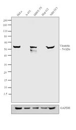 Vimentin Antibody in Western Blot (WB)