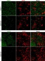 GFAP Antibody in Immunohistochemistry (IHC)