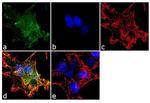 beta-2 Adaptin Antibody in Immunocytochemistry (ICC/IF)